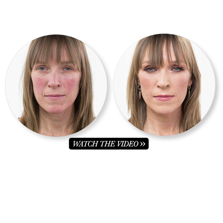 charlotte tilbury magic cream rosacea